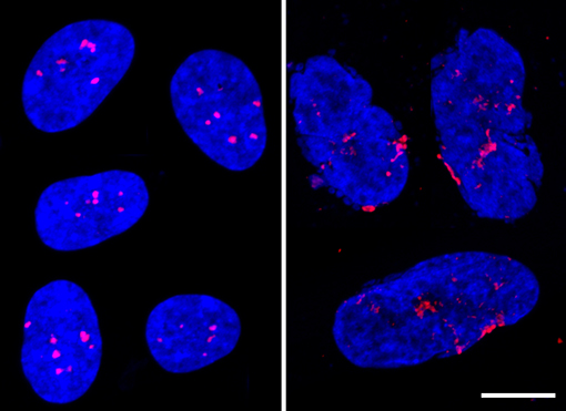 nuclei